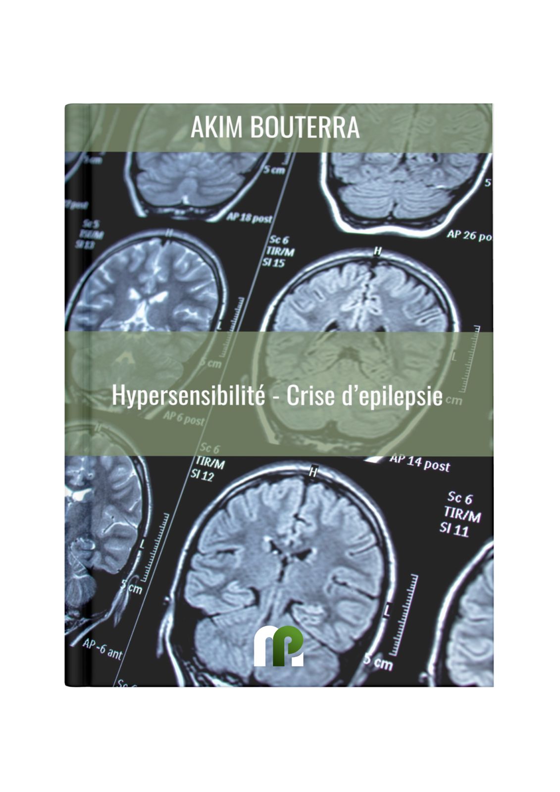 L'Hypersensibilité